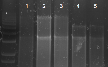 File:KAH 010310 gel1.tif