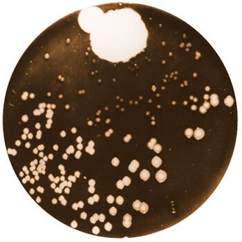 Fleming's original culture plate