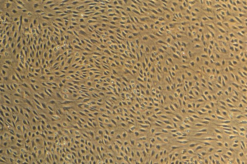 File:Pat-Postflow-05 22 14.jpg