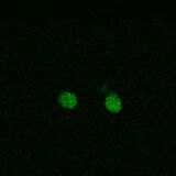 WT SOD1, induction at 37°C