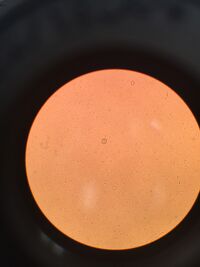 Picture of Arcella located near the middle of the picture