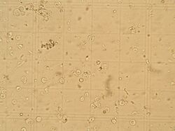 Protoplasts on a hemocytometer.