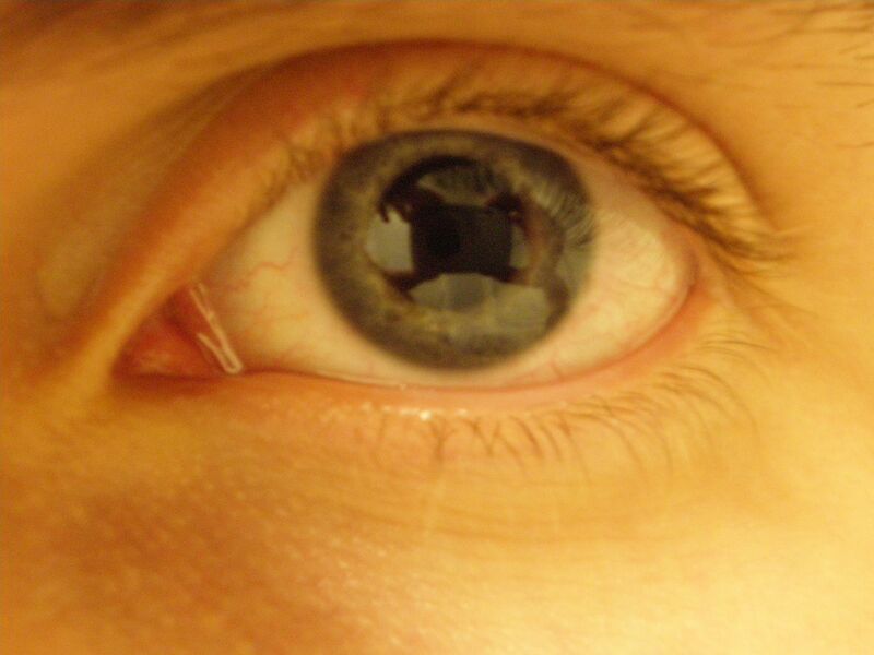 File:Eye1.jpg