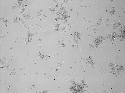 Representative Brightfield micrograph image of transformed protoplasts after 4 hours of incubation, 20x magnification.