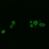 A4V SOD1, induction with 1:100 paromomycin dilution (140 μM)