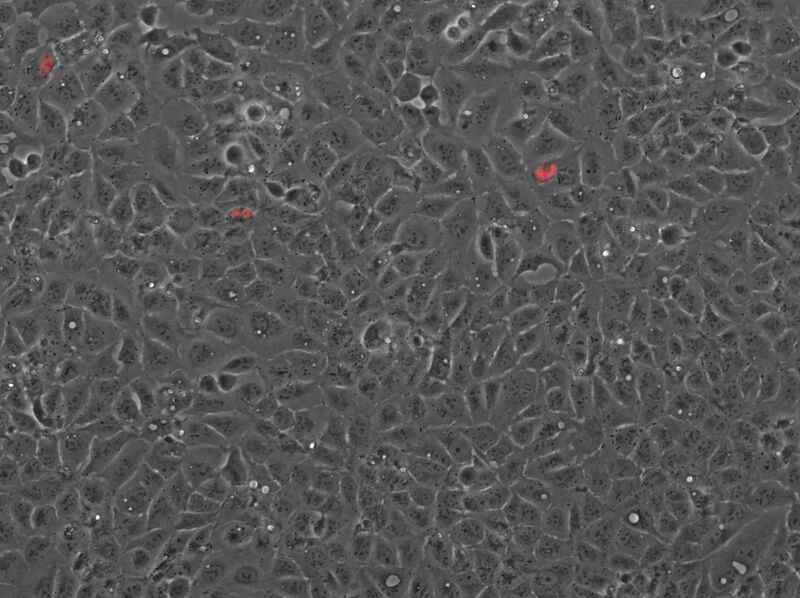 File:2014-12-17 U2OS cells transfected with mCherry-PcTF.jpg