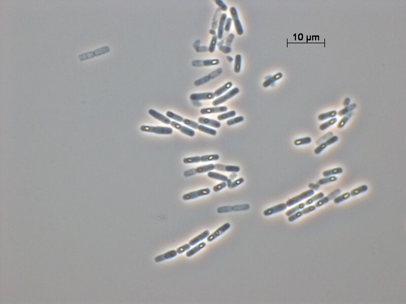 File:4Q7 48 h caldo.JPG