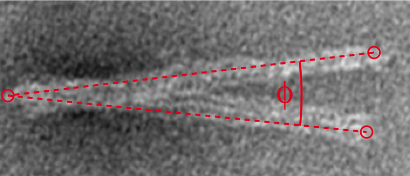 File:TUM TEM arm measure.jpg
