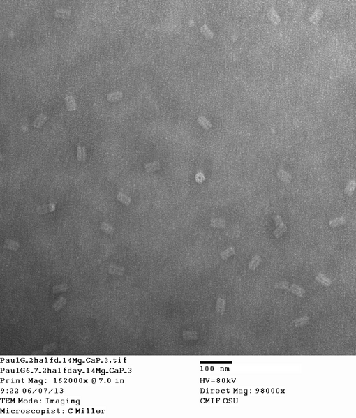 File:PaulG 2halfd 14Mg CaP 3.tif