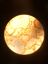 Figure 2.2. Picture of the algae collected from the top of the Hay Infusion Culture.