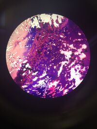 Picture of 10^(-7) no tet. The cells have irregular shapes and so there is a variation in the cell size. Measures 4µm to 20µm at 40X magnification