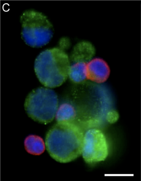 File:Ctc cluster.png
