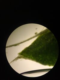 Picture of 3. through the microscope. Vascularization.