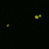 A4V SOD1, induction at 37°C