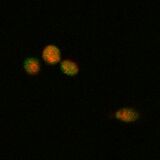 WT SOD1, induction with 10 min. heat shock at 50°C