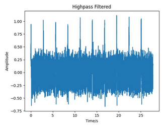 Figure 2.4b: Artificial ECG with High Pass Filter Applied with a cutoff frequency of 0.5Hz
