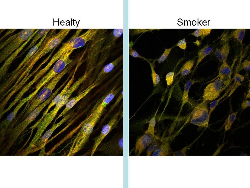 File:IF, CTRvsCSE.jpg