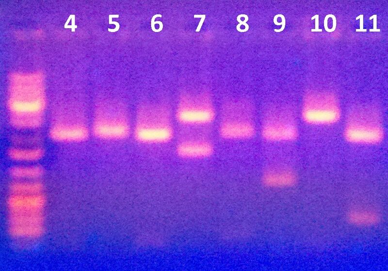File:Electrophoresis March 29 2012.jpg