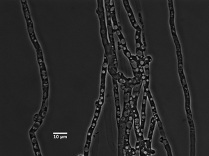 Micrograph of G. lucidum hyphae.