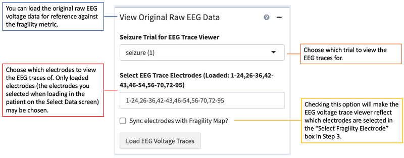 File:View Original Raw EEG Data.png