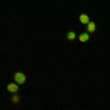 WT SOD1, induction at 30°C