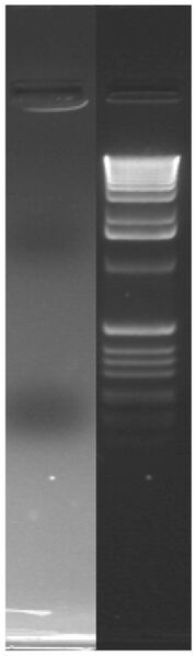 File:AgaroseGel 2 XCBPB.jpg