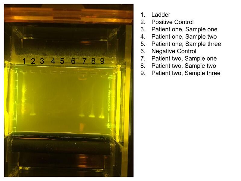 The results of the Electrofibrosis study for group eight