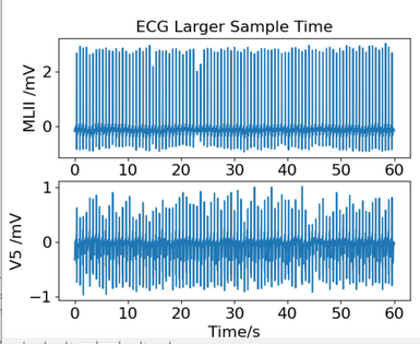 Input and Display Larger Sample of ECG