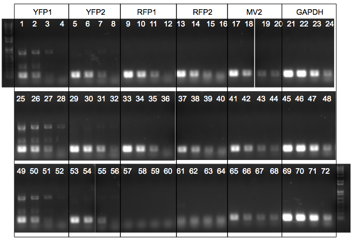 File:KAH 010410 gel1.tif
