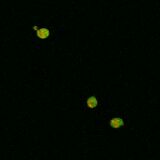 WT SOD1, induction with 1:100 paromomycin dilution (140 μM)