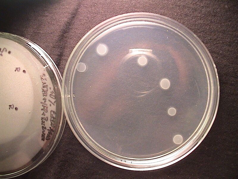 File:30EikenAgar YFPSender+Receiver 8hours.JPG