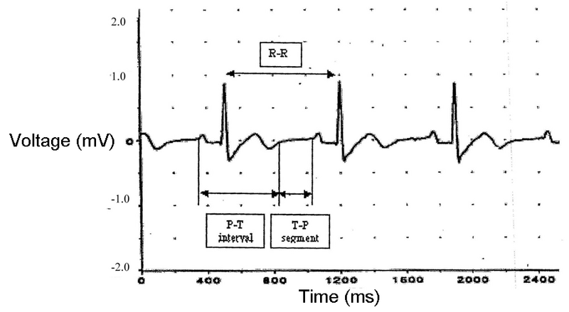 File:Labeled ECG S11.png