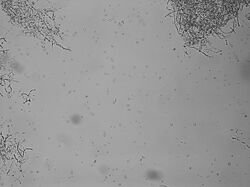 Protoplasts being released from hyphae.