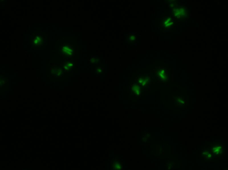 File:PDD test 1hr 3 eGFP.JPG