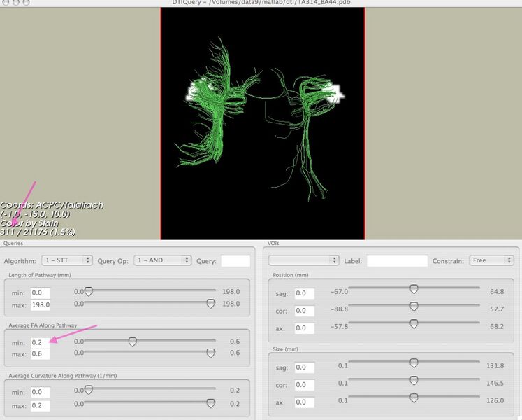 File:TA314 minFA.jpg