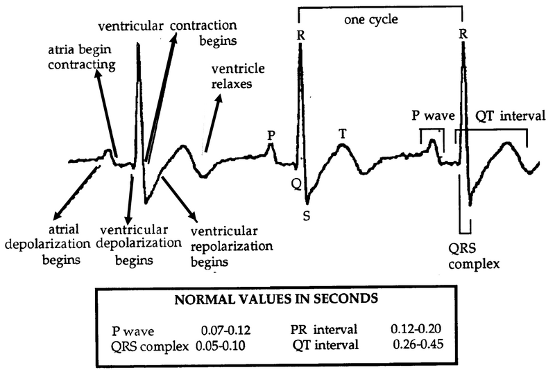 File:ECG S11.png