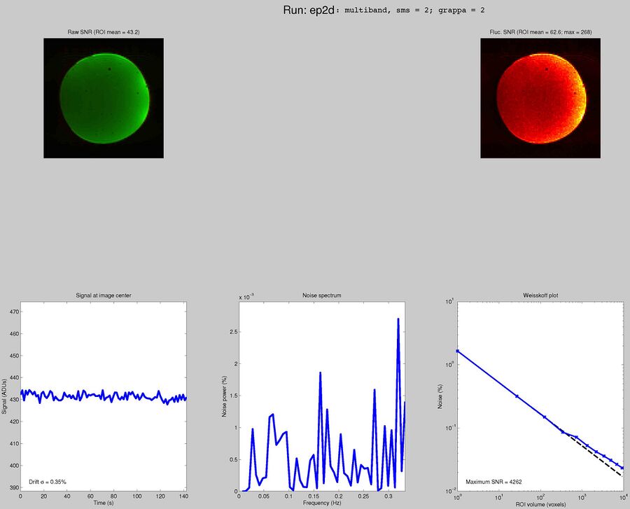 MGH Blipped CAIPI multi-band EPI with SMS 2, GRAPPA 2, TR = 1.5 seconds