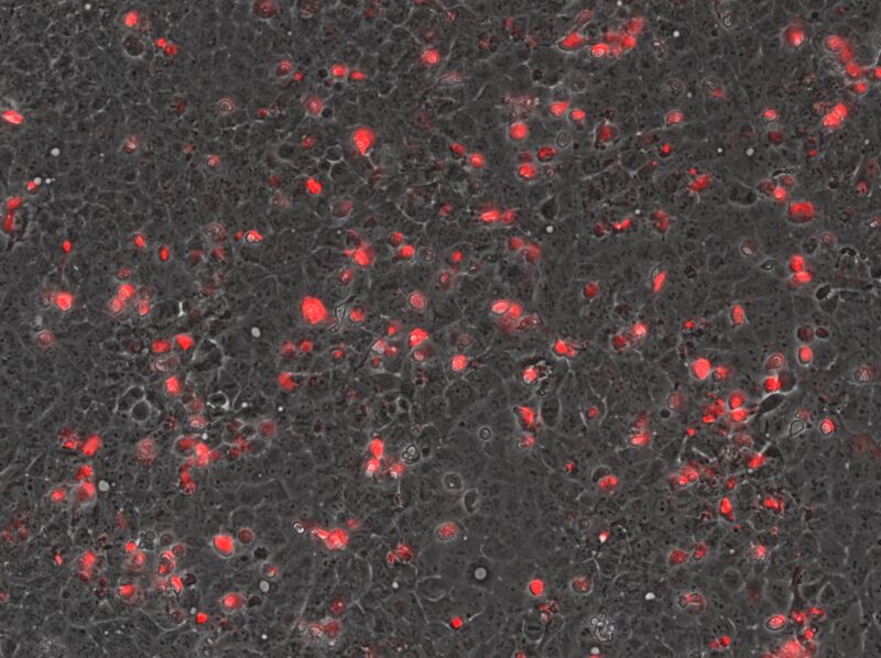 File:2015-05-11 Well 2 KAH126-MV2 phase mCherry10x.jpg