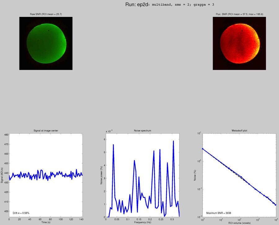 MGH Blipped CAIPI multi-band EPI with SMS 2, GRAPPA 3, TR = 1.5 seconds
