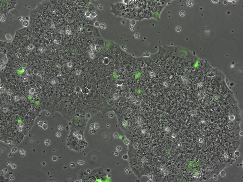 File:2015-10-27 Well 1 phase GFP 10x.jpg