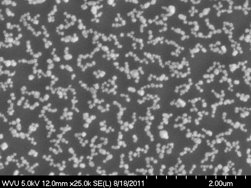File:SEM-B16F0-Exosome.TIF