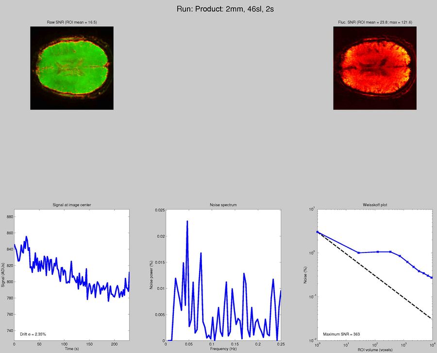 Siemens EPI product sequence with GRAPPA 3, TR = 2 seconds