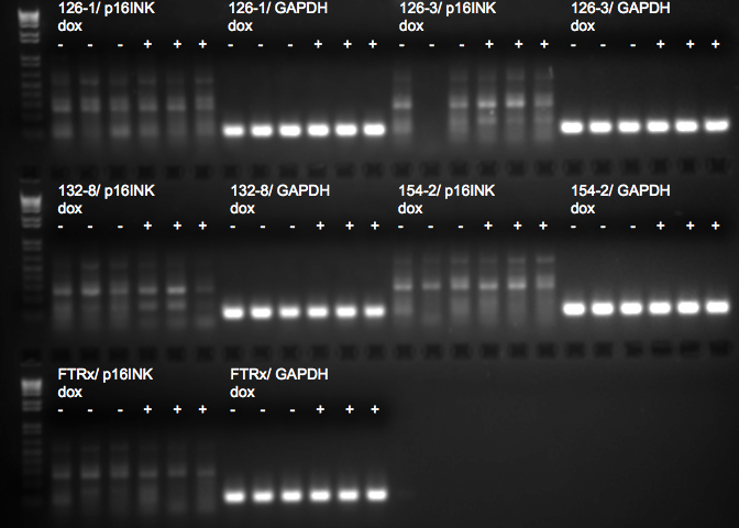 File:KAH 070210 gel1.tif