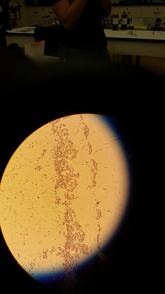 File:Gram positive 10^-3 with TET.jpg