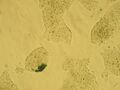 weak LacZ stain from modified mouse embryonic stem cells, 200x - 2/07