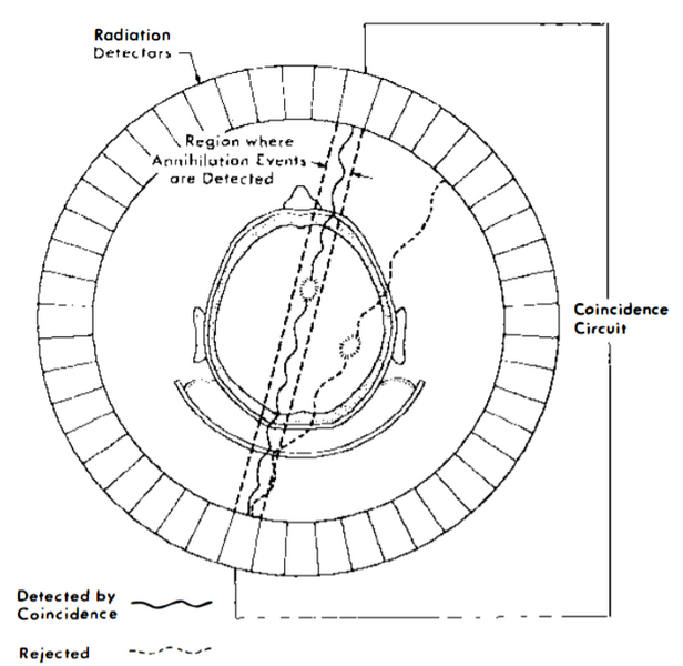 File:Coincidence Detection.png