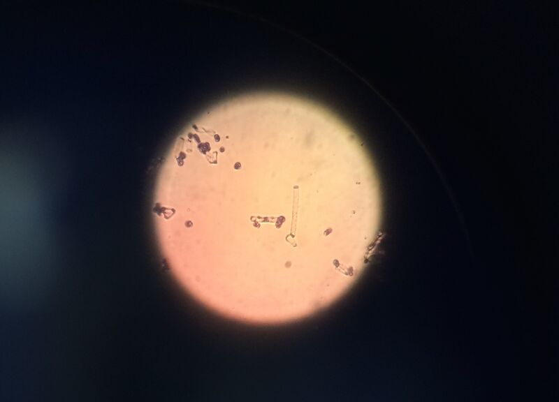 File:Gram stain tet 10^-3.jpg