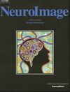 NeuroImage RAVE cover