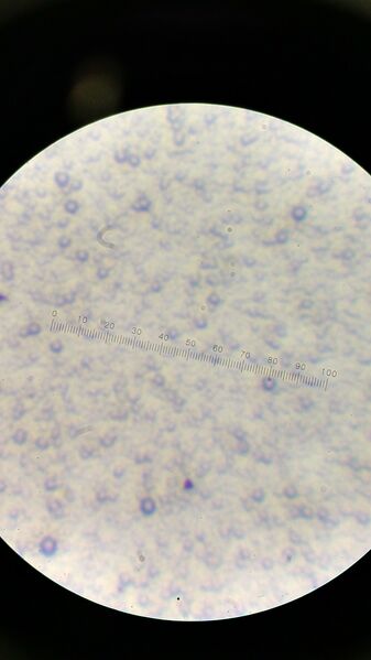 File:Bacteria4TKatrina.jpg