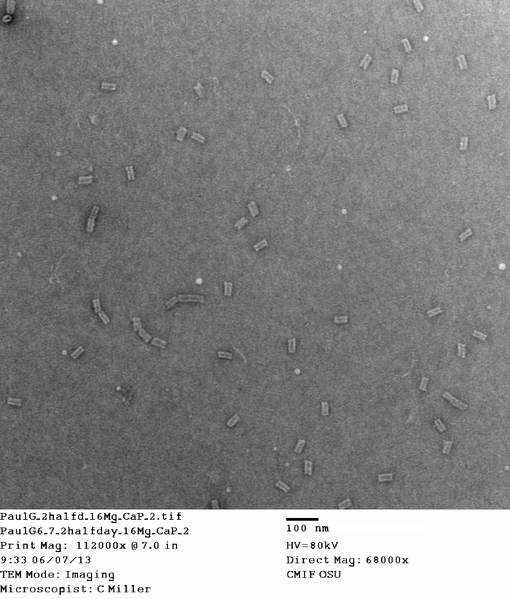 File:PaulG 2halfd 16Mg CaP 2.tif